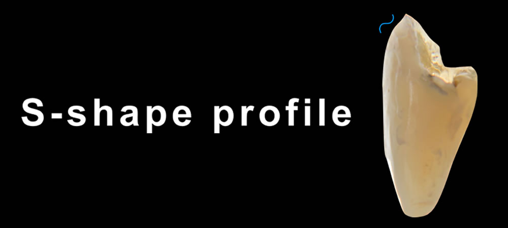 S-shapeプロファイル