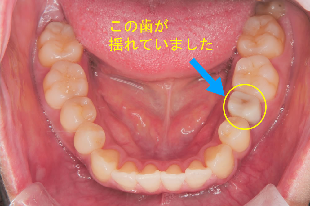 初診時の状態
