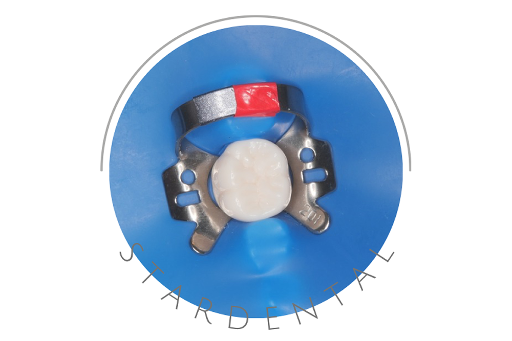 ラバーダム防湿