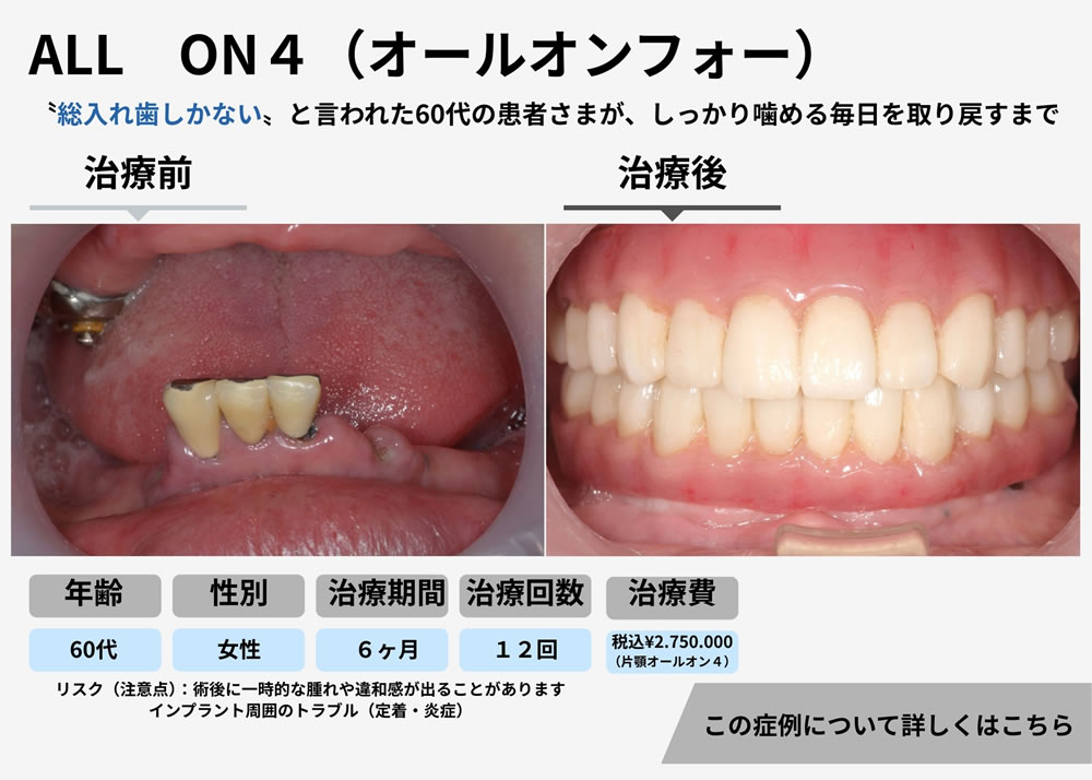 ALL ON4（オールオンフォー）